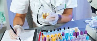 Analysis of urine