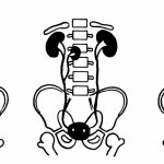 аномалии количества почек