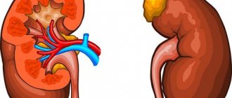 kidney disease symptoms and treatment