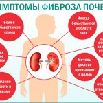Фиброз почек: симптомы