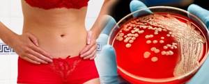 Инфекции, вызывающие цистит у женщин: возбудители, лечение