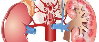 Interstitial nephritis is an inflammatory process that affects the interstitial tissue of the kidneys