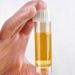 Колба с мочой