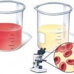 Blood in urine