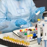 Лаборант моча