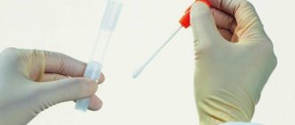 Мазок из уретры