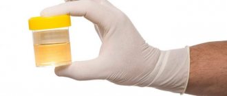 urine