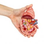 uric acid infarction in newborns