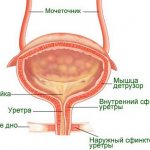 На фото: шеечный цистит