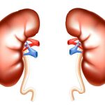 Нефроз, виды невфозов.