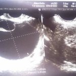 образование на снимке