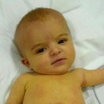 kidney failure symptoms in children under one year of age