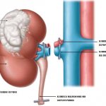 процедура удаления