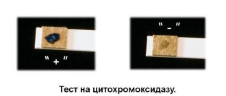 Pseudomonas aeruginosa