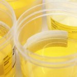 Сколько можно хранить мочу для анализа до сдачи в лабораторию