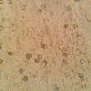 Соли в моче под микроскопом