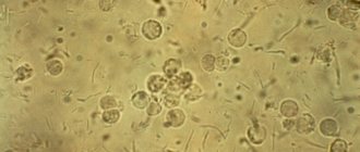 Sperm in urine