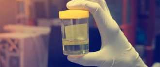 Light urine in hands