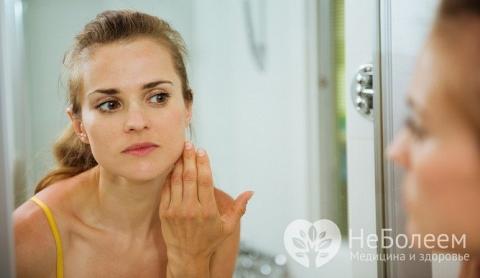 Ухудшение состояния кожи - один из симптомов почечной недостаточности