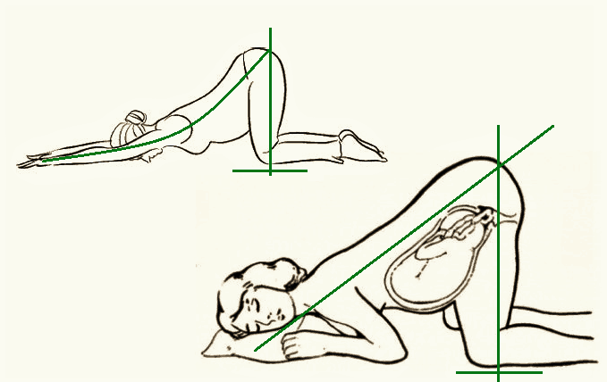 Зачем беременным стоять в коленно локтевом положении фото