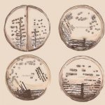 Виды бактерии в моче и откуда они берутся